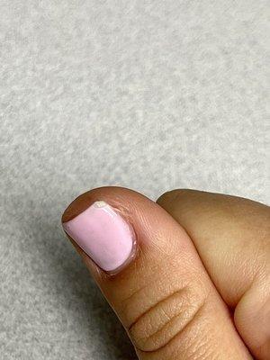 Chipped nail