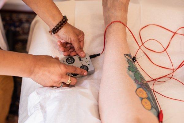 electroacupuncture