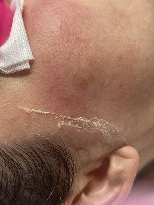 dermaplaning * removal of dead skin & vellus hair