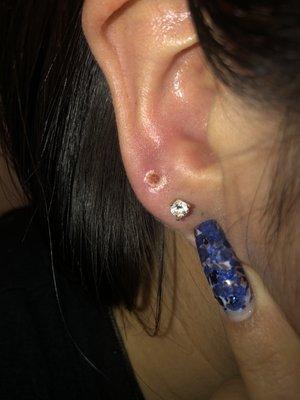 Ear piercing