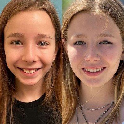 Look at this beautiful orthodontic before and after. We are so excited for new smiles!