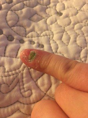 They used a dirty electric file and dug too deep into my nail bed. Now my nail has fallen off and my cuticle is green.