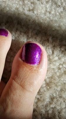 Messy polish job, topcoat outside of crooked nail