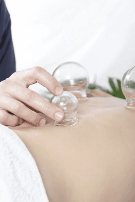 Hijama/Cupping Therapy is a traditional alternative medicine method used for thousands of years to treat various medical concerns.