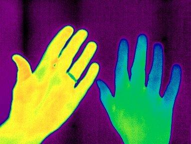 See Heat Patterns in Your Body with Thermography