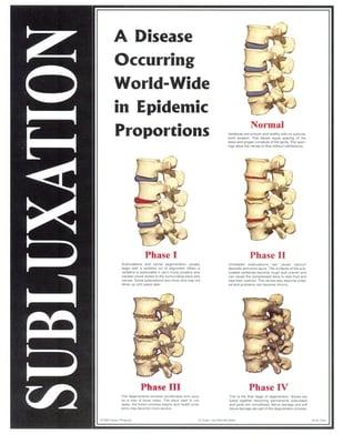 Subluxation Phases