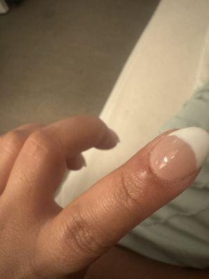 Cut on skin from the nail drill