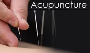 $45.00 per Acupuncture session.  Performed by Dr. Jon Tanner, DC in practice since 1996.  www.doctortanner.com