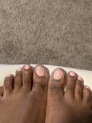 This is what happened after wearing closed toe shoes 6 hours after completing my pedicure