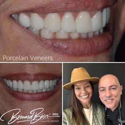 Porcelain Veneers, Invisalign