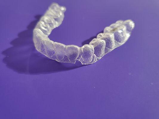 Second cracked aligner (#9 out of 11)