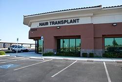 Halby Hair Transplant Office