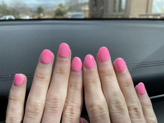 Uneven shaping of my nails.