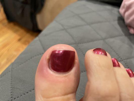 Manicurist caused a nasty nail infection