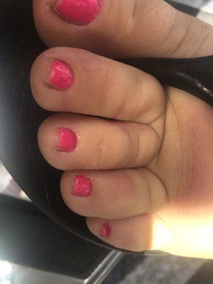 Worst pedicure