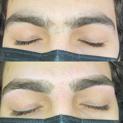 Before and after brow thread