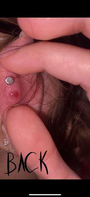 Back of piercing