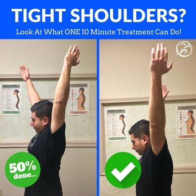 Using myofascial release techniques we are able to unlock shoulder injuries much faster than typical treatment methods