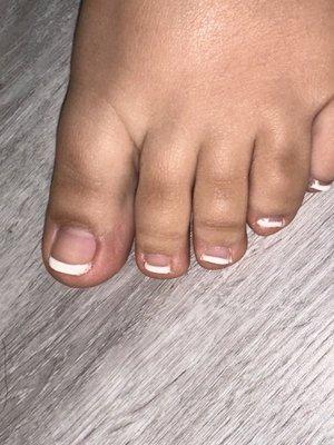 Bad Pedicure