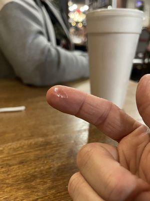 Chipped glass off my beer glass I nearly swallowed.