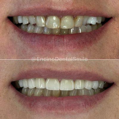 Encino Dental Smile