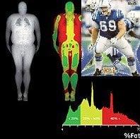 SB XLI Champion Matt Ulrich , Body Fat Test