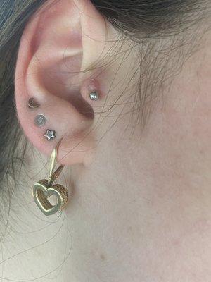 Infected tragus