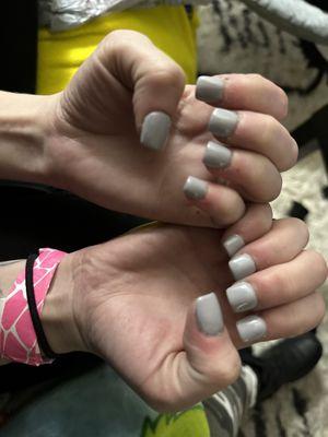 uneven nails