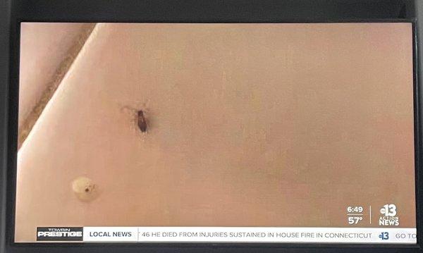 ROACHES! Ewwww!!! On DIRTY DINING! Channel 13 News!