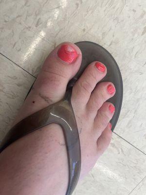 Bad Pedicure