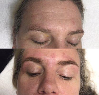 Brows before and after by  Brooke Gellici @beautiqueskinstudio.