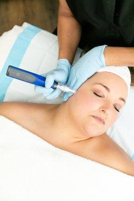 We recommend micropenning or microneedling to brighten the skin and address texture.