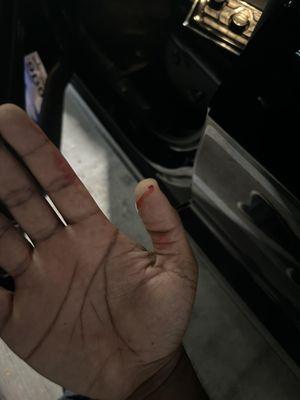 Hand bleeding due to broken glass from car being vandalized in the parking garage. Leasing office refused to release the video to me.