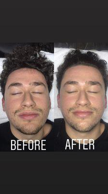 "The Natal Being" (Customized Facial) Men have skin too!