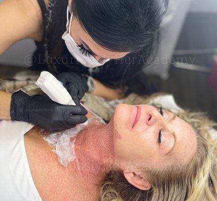 Plasma Fibroblast neck skin tightening