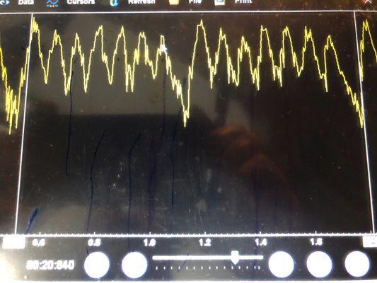 Checking a compression with scope.