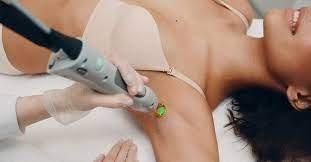 Laser hair removal is a medical procedure to reduce unwanted hair and areas of choice