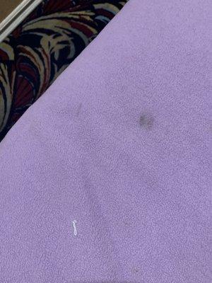 Stain on bed sheet