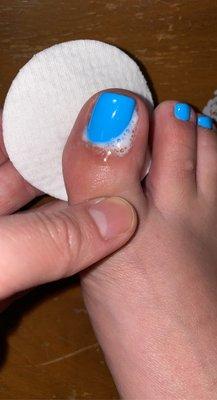 Pedicure effected