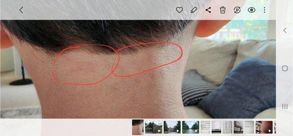 Red marks due to skin aberration by the electric razor in this GreatClips place.