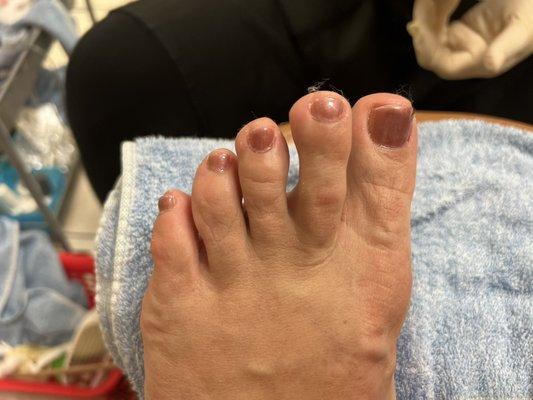 Gel pedicure