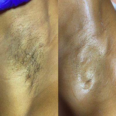 Women's Underarm Wax