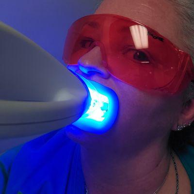 Zoom whitening!