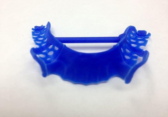 Dental Works 3d printing