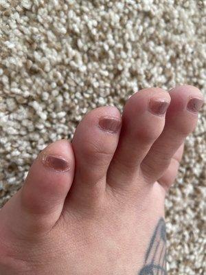 Pinky toe is missing nail polish in some spots