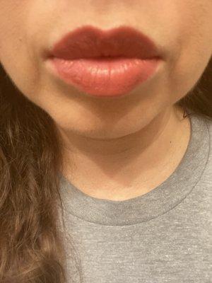 After one day , full lips all around , evened out all over .