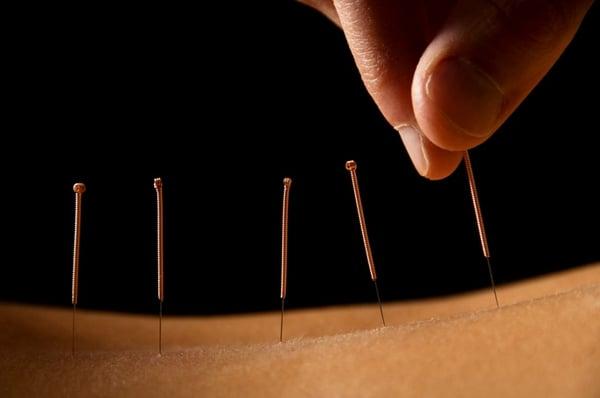 San Clemente Chin's Acupuncture Center-http://www.chinsacupuncture.com