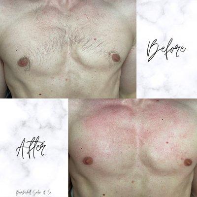 Before & After Men's Chest Wax