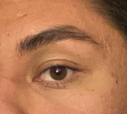 Right eyebrow