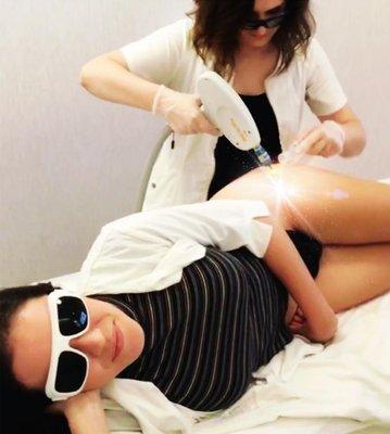 Laser hair removal in NYC